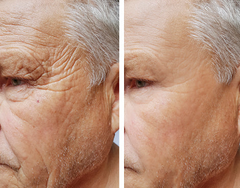 Derma Led mask™
