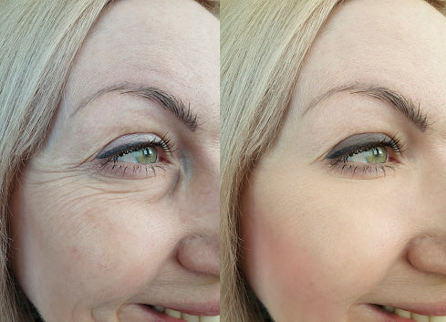 Derma Led mask™