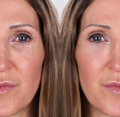 Derma Led mask™